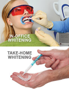 woman getting teeth whitened vs at home whitening