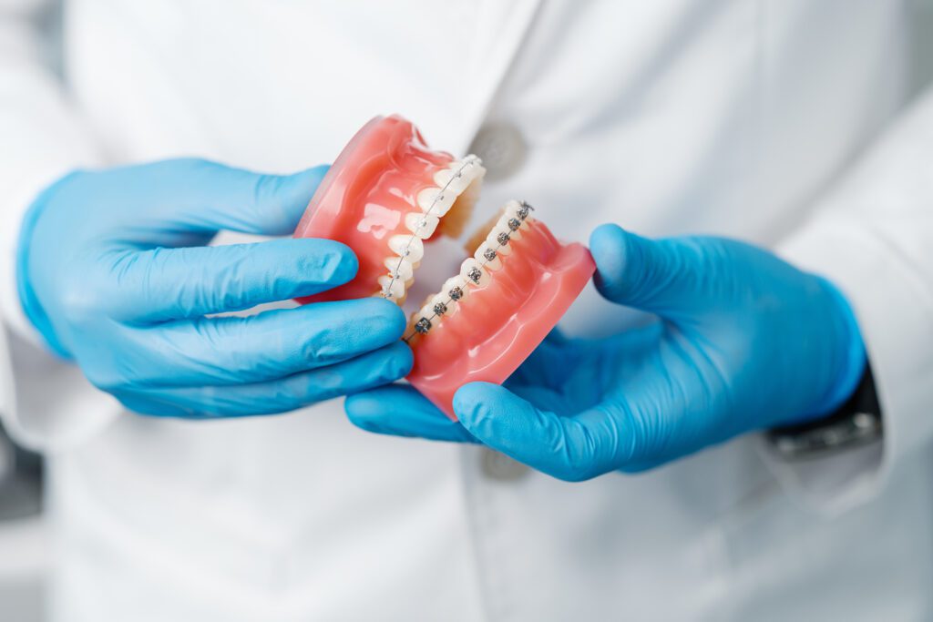 orthodontic treatment