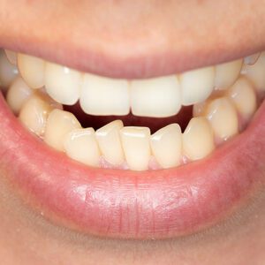 Orthodontist in Chandler