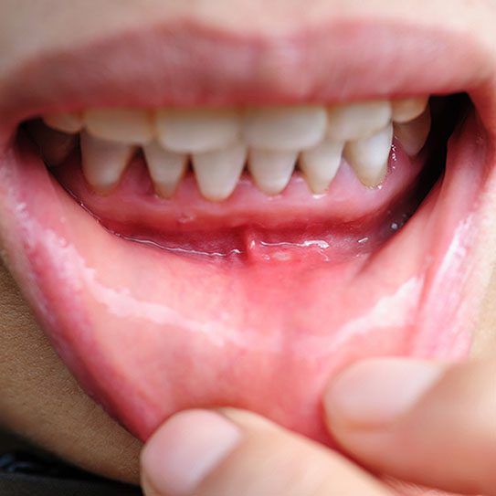 Orthodontist in Chandler